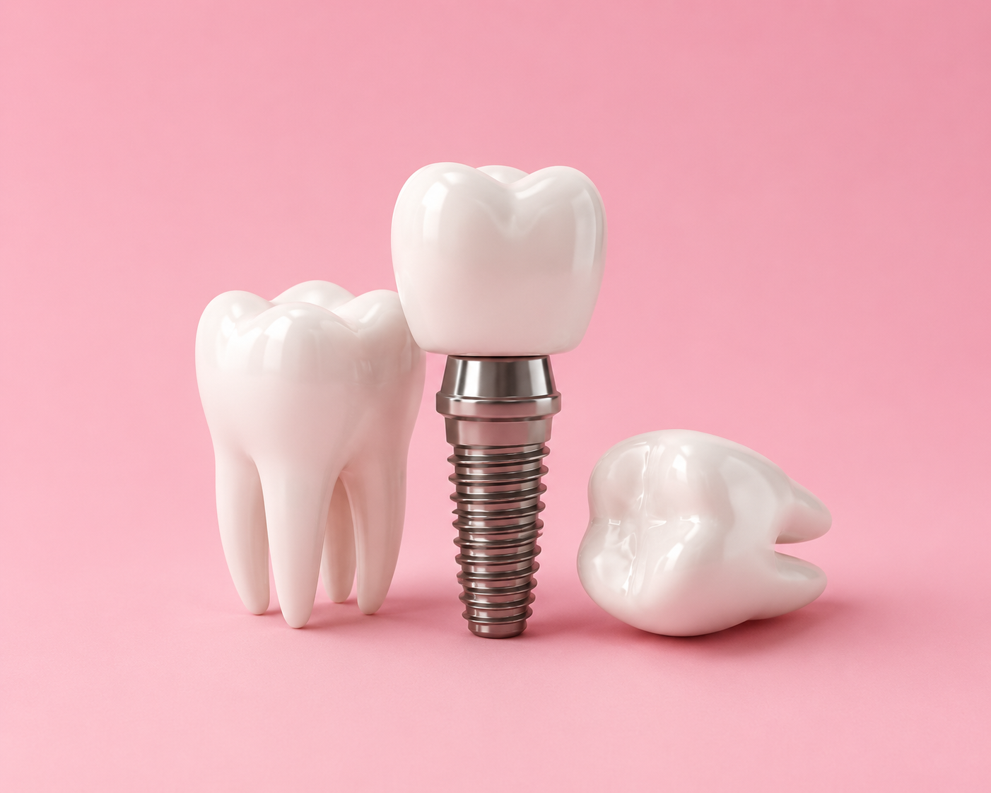 Implante Dentário Dói? Mitos e Verdades que Você Precisa Saber